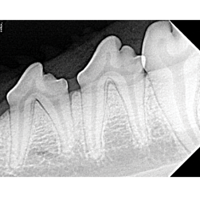 Dental Xray Positioning Guide Canine Mandibular Premolars 307 and 308 D.A.V.I.D. XRAY