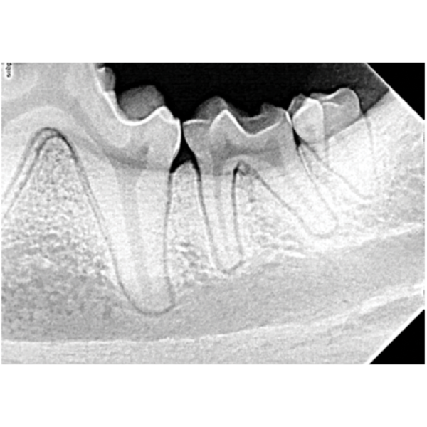 Dental Xray Positioning Guide Canine Mandibular Molars 310 and 311 D
