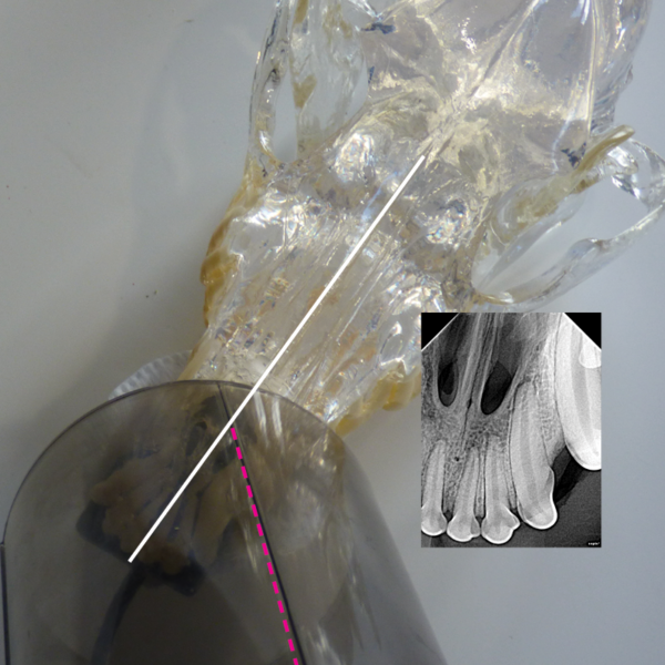 Dental Xray Positioning Guide Canine Incisors 101 103 D.A.V.I.D