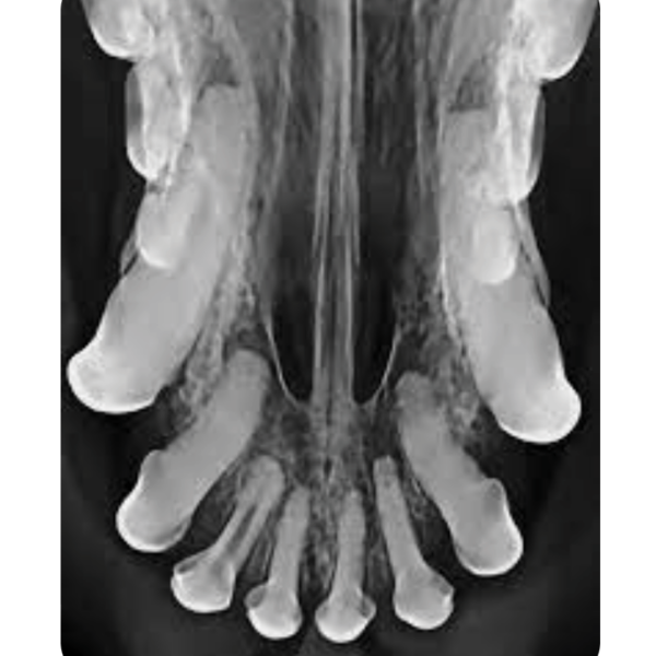 Dental Xray Positioning Guide Canine Incisors 101 103 D.A.V.I.D
