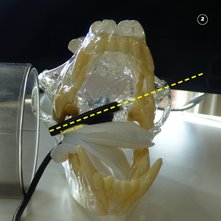 Dental Xray positioning guide Maxillary Molars 109 and 110 D.A.V.I.D. XRAY